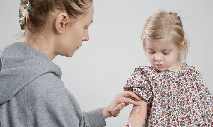 Atopický ekzém u dětí: Jak zklidnit citlivou pokožku