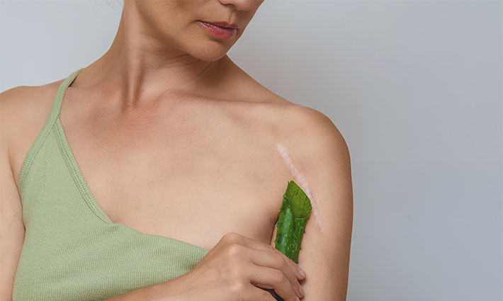 Jak pečovat o jizvy, aby se správně zahojily