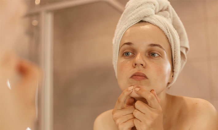 Jak vznikají ucpané póry a co s nimi?