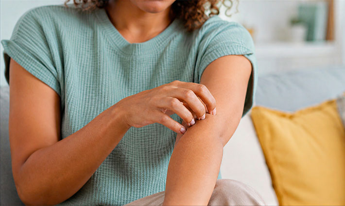Atopický ekzém neovlivňuje jen kůži. Zasahuje i psychiku